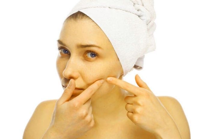 Acne, What To Eat And What To Avoid