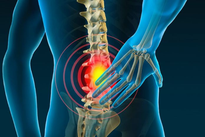 Six Simple Home Remedies To Relieve Back Pain