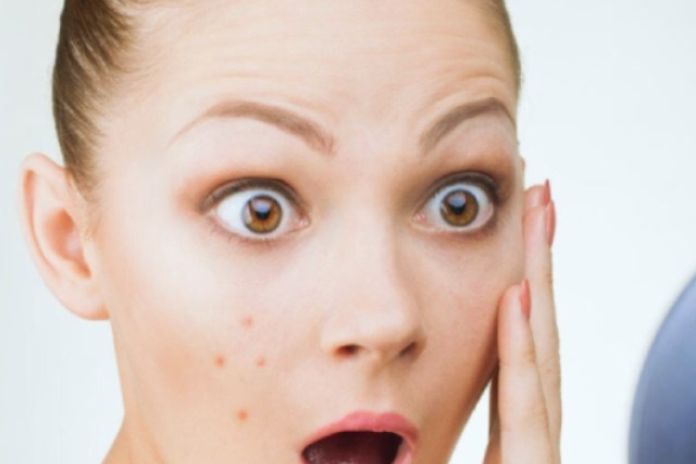 Natural Cosmetics For Acne-Prone Skin