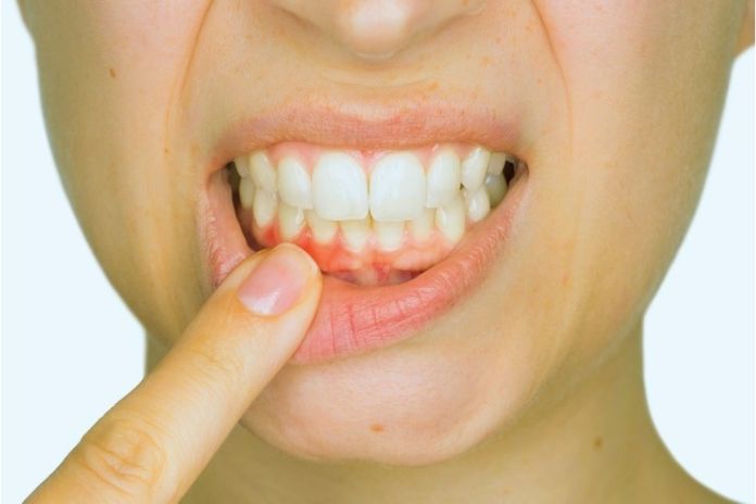 Taking Care Of Your Teeth